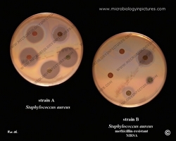 staphylococcus aureus susceptibility testing
